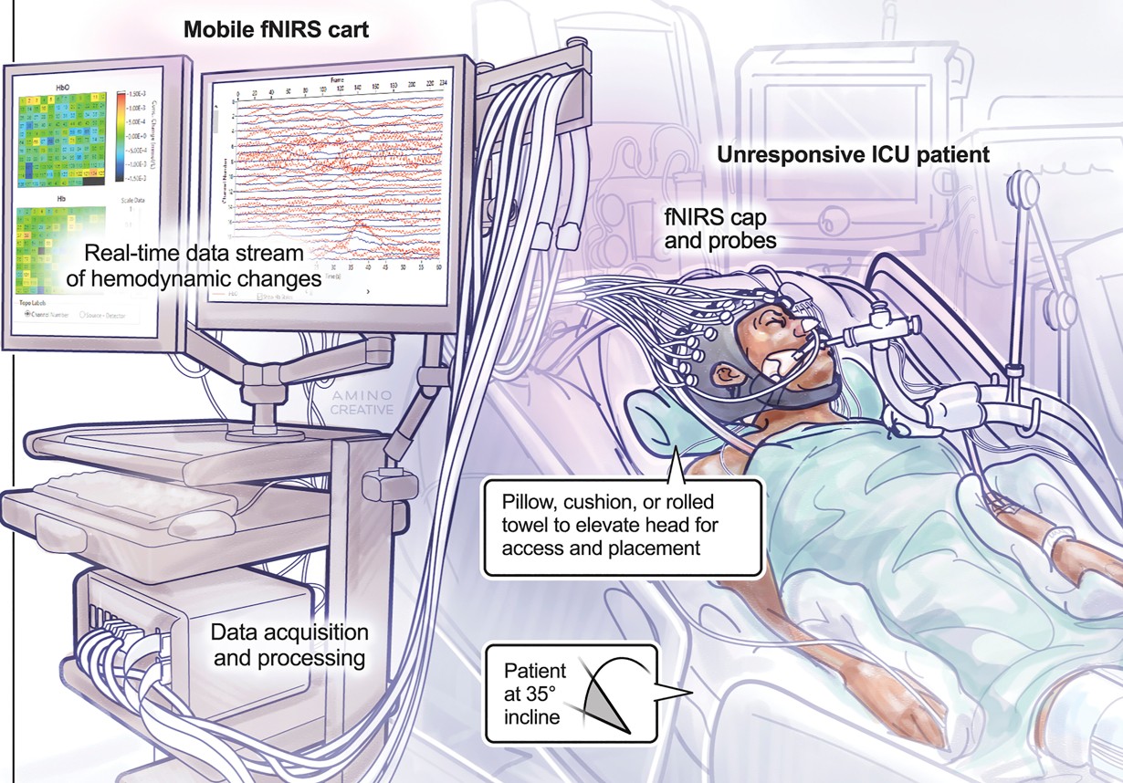 Functional near-infrared spectroscopy: A novel tool for detecting consciousness after acute severe brain injury